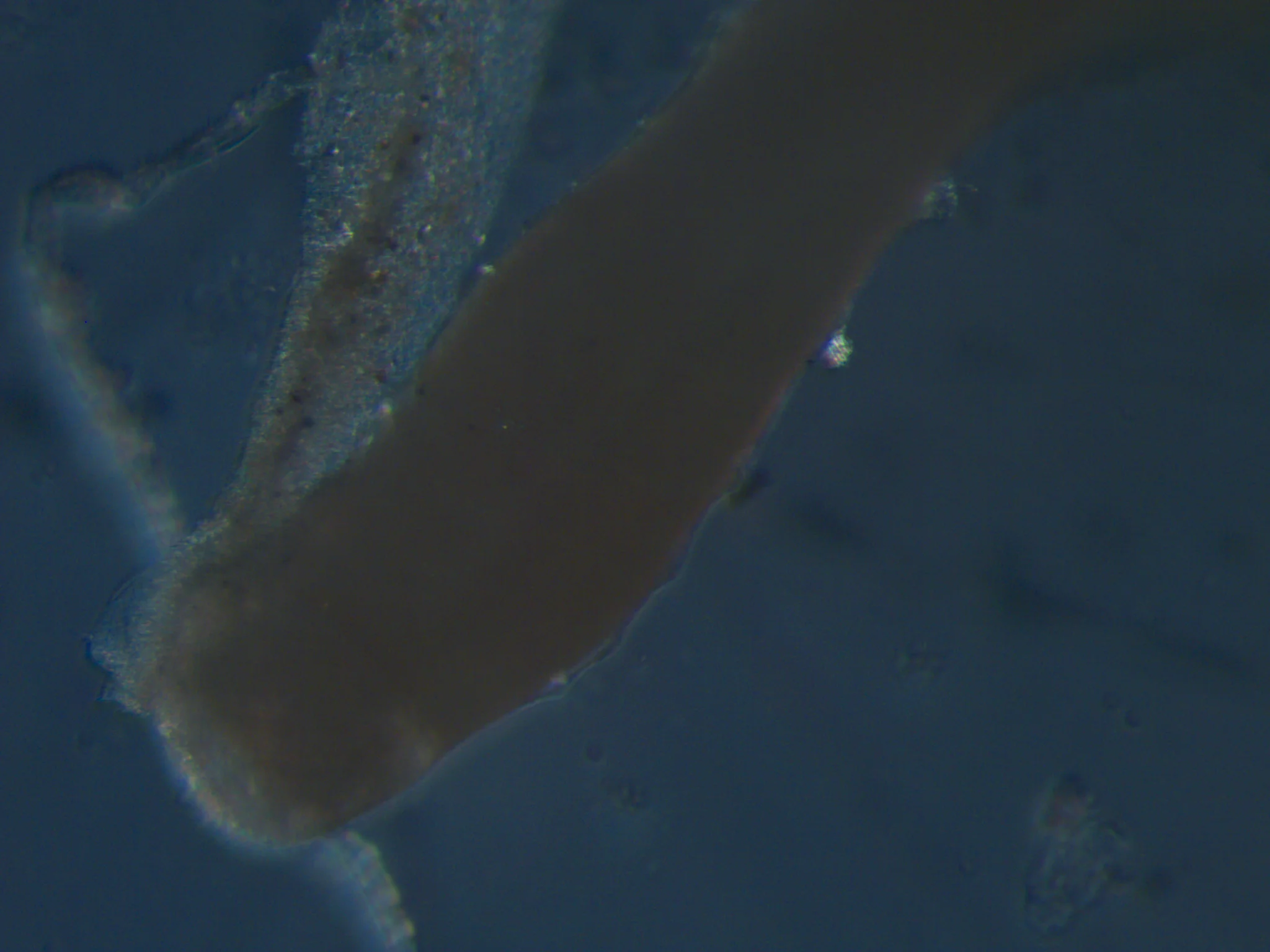 Heteromastus filiformis